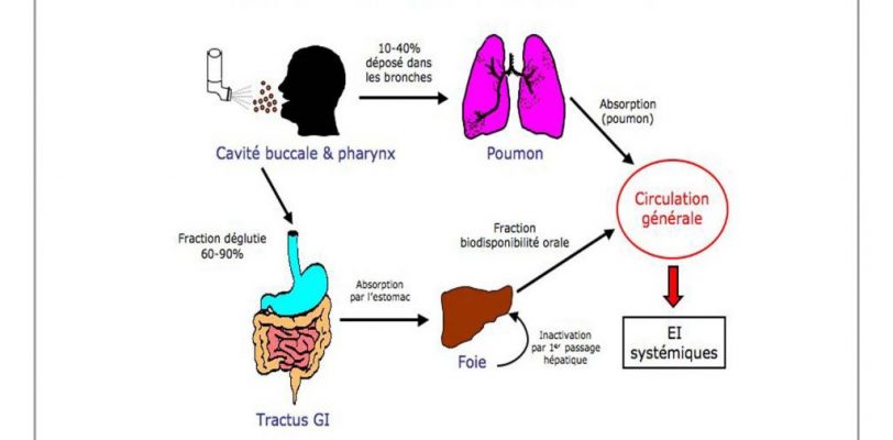 Corticoide, vous allez découvrir un traitement efficace Corticoide, vous allez découvrir un traitement efficace